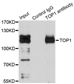 Immunoprecipitation - TOP1 Polyclonal Antibody (144-12524)