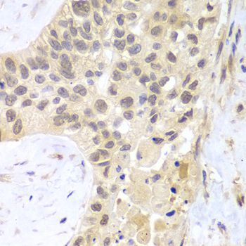Immunohistochemistry - PSMC5 antibody (144-60382)