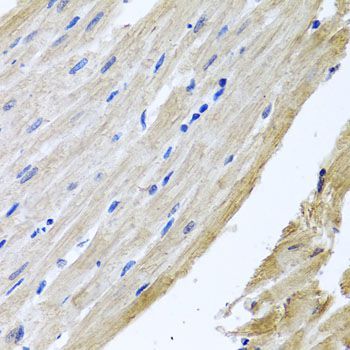 Immunohistochemistry - PRPH antibody (144-04048)