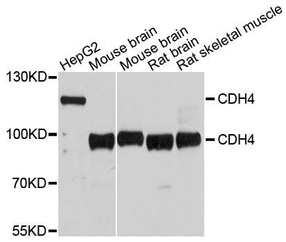 Western blot - CDH4 Polyclonal Antibody (144-10557)