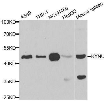 Western blot - KYNU antibody (144-06643)