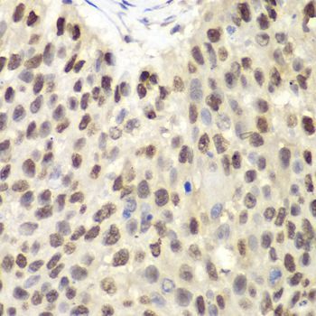 Immunohistochemistry - MCM6 antibody (144-01955)