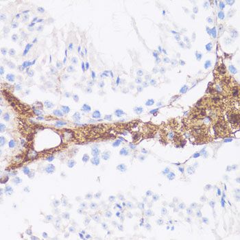 Immunohistochemistry - VTN Polyclonal Antibody (144-61313)