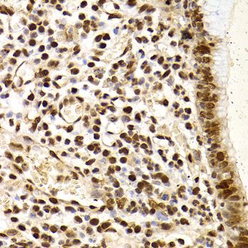Immunohistochemistry - XRCC4 Polyclonal Antibody (144-01677)