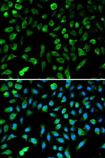 Immunofluorescence - NME1 Polyclonal Antibody (144-00259)