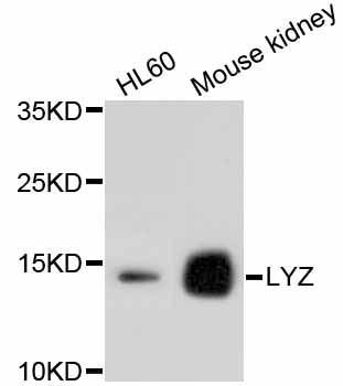 Western blot - LYZ antibody (144-10972)