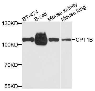 Western blot - CPT1B Polyclonal Antibody (144-06796)