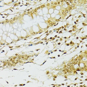 Immunohistochemistry - ADAR Polyclonal Antibody (144-07869)
