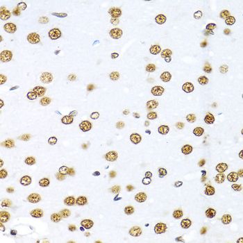 Immunohistochemistry - KHDRBS1 antibody (144-06101)
