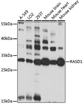 Western blot - RASD1 antibody (144-61062)