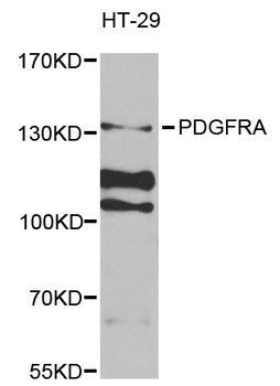 Western blot - PDGFRA antibody (144-02103)