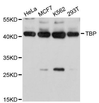 Western blot - [KO Validated] TBP Polyclonal Antibody (144-02192)