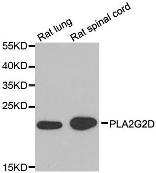Western blot - PLA2G2D antibody (144-07165)