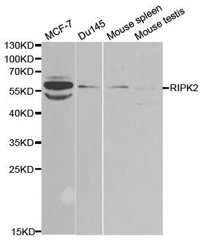Western blot - RIPK2 Polyclonal Antibody (144-02498)