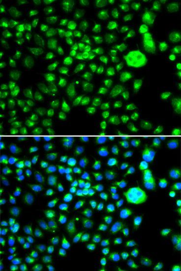 Immunofluorescence - SMCHD1 antibody (144-07214)