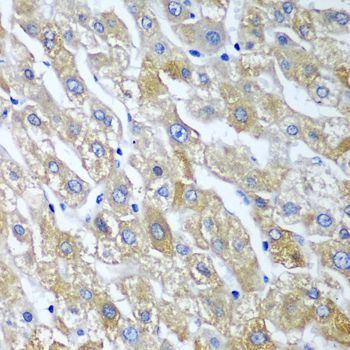Immunohistochemistry - SGSH antibody (144-08148)