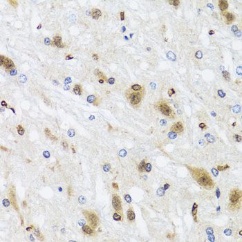 Immunohistochemistry - HDAC4 Polyclonal Antibody (144-00179)