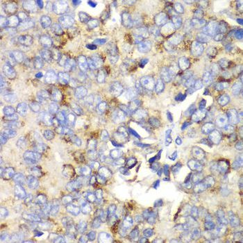 Immunohistochemistry - TFAM Polyclonal Antibody (144-013552)