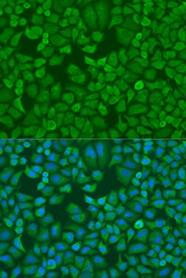Immunofluorescence - IGF2BP1 antibody (144-01517)