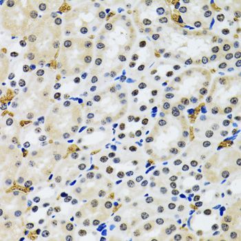 Immunohistochemistry - TP53BP1 antibody (144-05757)