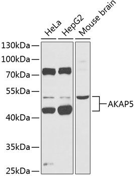 Western blot