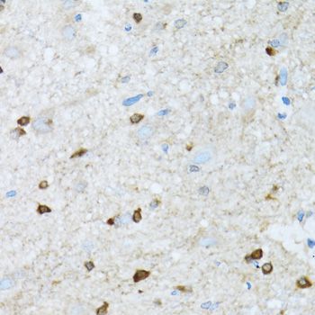 Immunohistochemistry - ROCK2 Polyclonal Antibody (144-05698)
