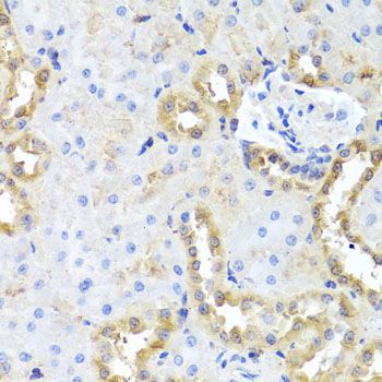 Immunohistochemistry - CGB7 antibody (144-08522)