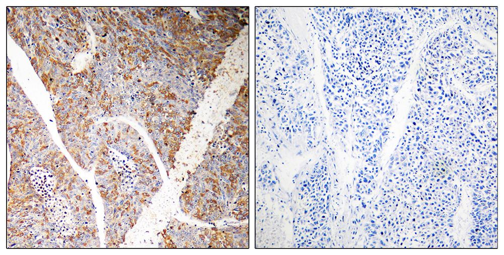 IHC