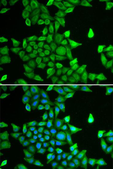 Immunohistochemistry - PSMA6 Polyclonal Antibody (144-60381)