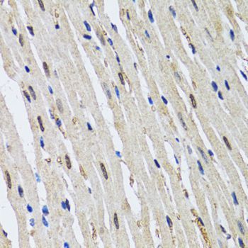 Immunohistochemistry - TP53BP1 antibody (144-05757)