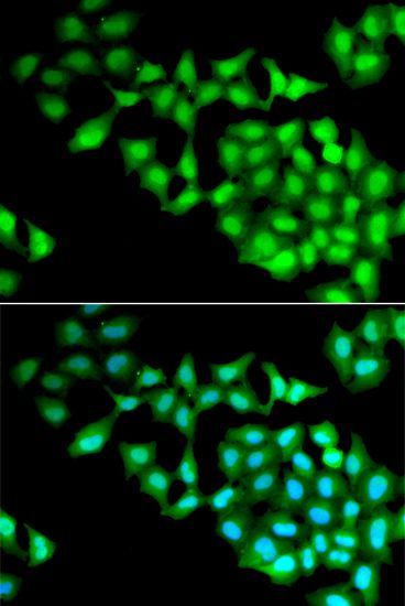 Immunofluorescence - RNGTT Polyclonal Antibody (144-06431)