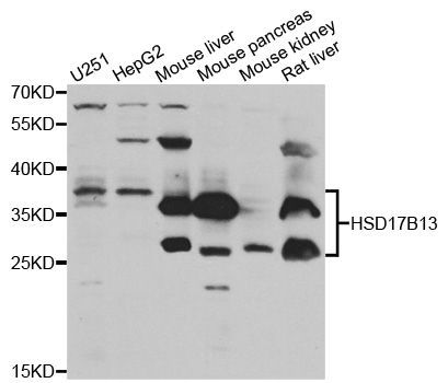 Western blot - HSD17B13 antibody (144-06256)