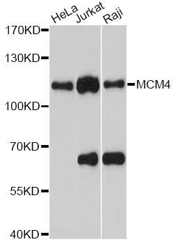 Western blot - MCM4 antibody (144-013513)