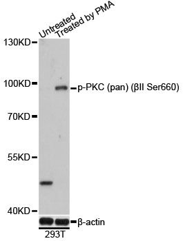 Western blot - Phospho-PKC (pan) (?II Ser660) antibody (144-61499)
