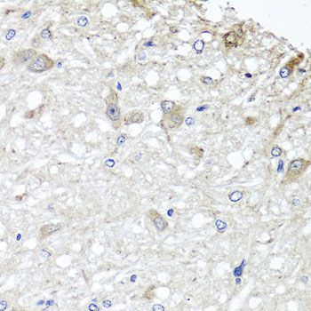 Immunohistochemistry - METTL13 Polyclonal Antibody (144-07111)