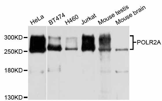 Western blot - POLR2A Polyclonal Antibody (144-011181)