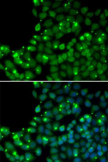 Immunofluorescence - MGMT Polyclonal Antibody (144-00693)