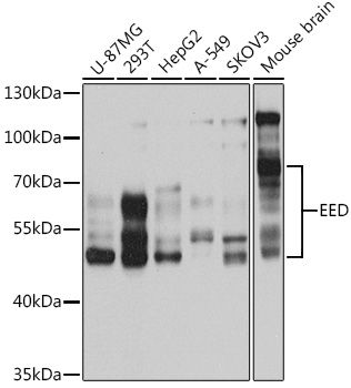 Western blot