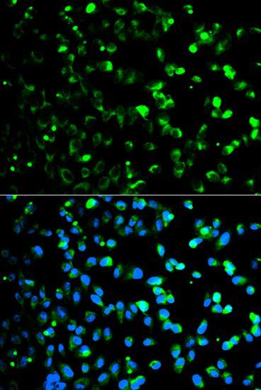 Immunofluorescence - TYMP antibody (144-01094)