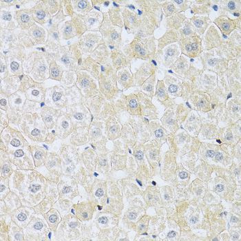 Immunohistochemistry - SLC4A5 Polyclonal Antibody (144-010436)
