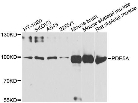 Western blot - PDE5A antibody (144-06831)