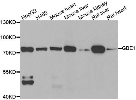 Western blot - GBE1 antibody (144-06599)