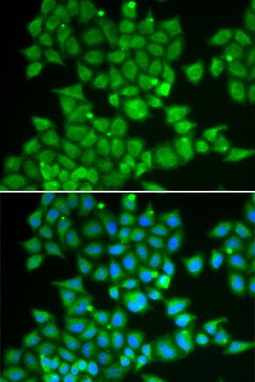 Immunofluorescence - PDE1B antibody (144-02102)