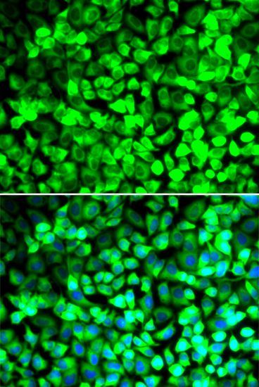 Immunofluorescence - EIF5 antibody (144-06583)