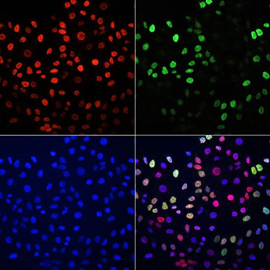 Immunofluorescence - TriMethyl-Histone H3-K27 pAb (144-02363)