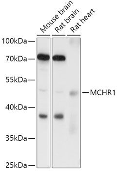 Western blot