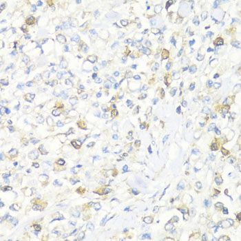 Immunohistochemistry - EIF3J Polyclonal Antibody (144-08637)