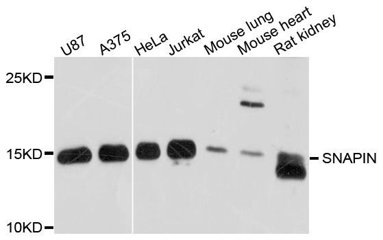 Western blot - SNAPIN Polyclonal Antibody (144-10294)