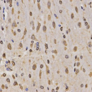 Immunohistochemistry - MonoMethyl-Histone H3-K4 antibody (144-61339)