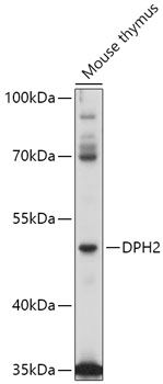 Western blot